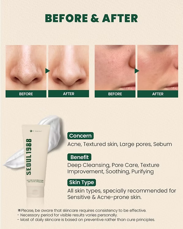Seoul 1988 Cleansing Foam : Pine Cica 1% + Probiotics