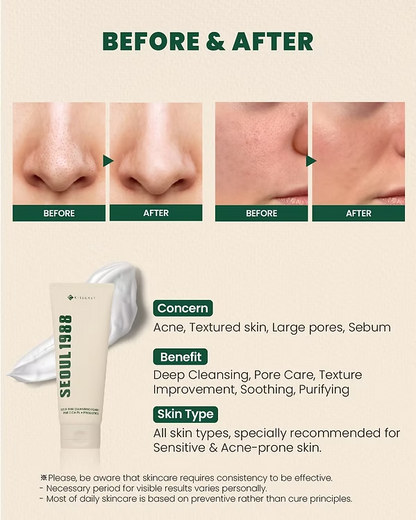 Seoul 1988 Cleansing Foam : Pine Cica 1% + Probiotics