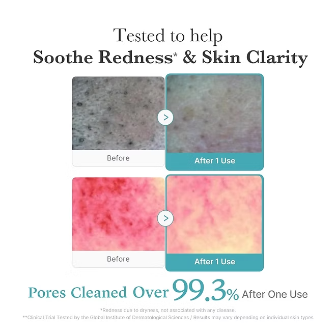 Medicube Azelaic Acid Niacinamide Deep Foam Cleanser