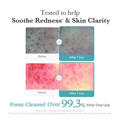 Medicube Azelaic Acid Niacinamide Deep Foam Cleanser