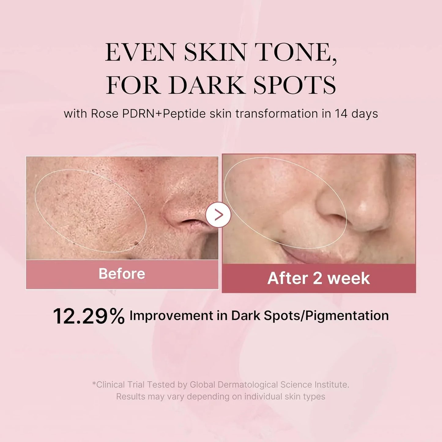 https://allurify.pk/products/medicube-pdrn-pink-cica-soothing-toner?variant=51734376251708