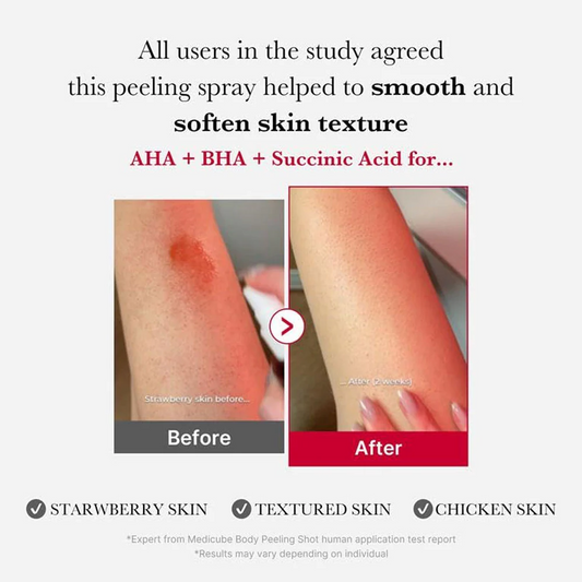 Medicube Red Acne Body Peeling Shot