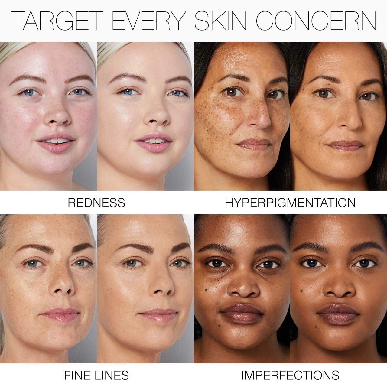 NARS - Light Reflecting Advanced Skincare Medium Coverage Foundation